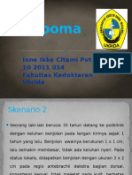 PBL Lipoma