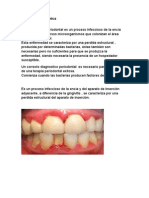 Periodontitis Crónica