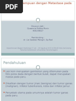 Download Gambaran Radiologi Metastase Pada Paru by Queencia Ditha SN284212056 doc pdf