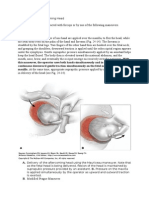 Delivery of The Aftercoming Head