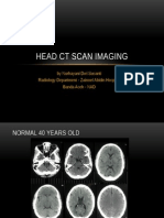 Head CT Scan Imaging: by Nurhayani Dwi Susanti Radiology Department - Zainoel Abidin Hospital Banda Aceh - NAD
