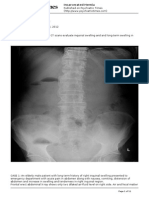 Incarcerated Hernia: Case Studies Sushila Ladumor, MD