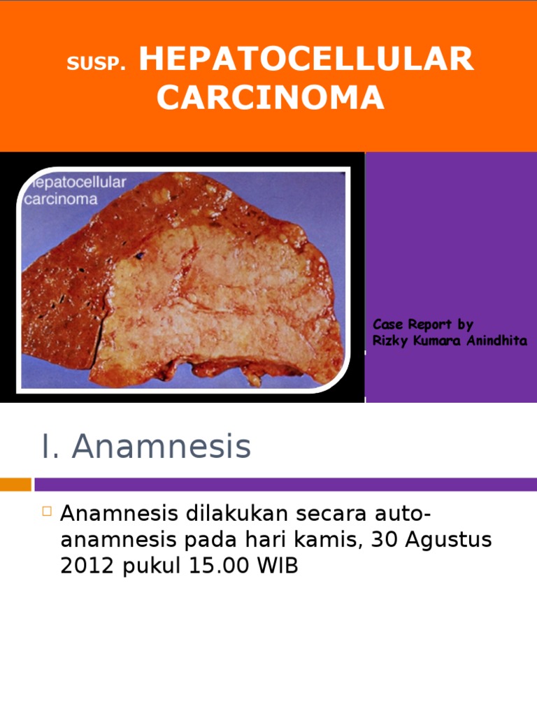 Hepatocellular carcinoma case study scribd picture