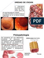 Crohn y Fistulas