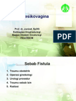 Fistula Vesikovaginal