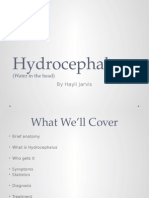 Hydrocephalus Power Point