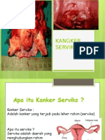Kangker Serviks