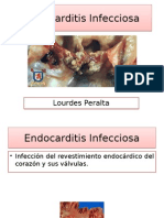 Endocarditis Infecciosa Guía