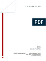  ECG Filtros