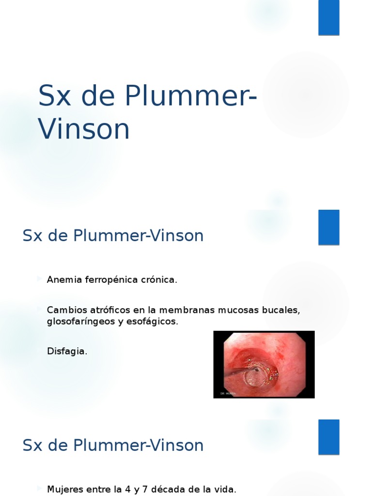 SX de Plummer-Vinson | PDF
