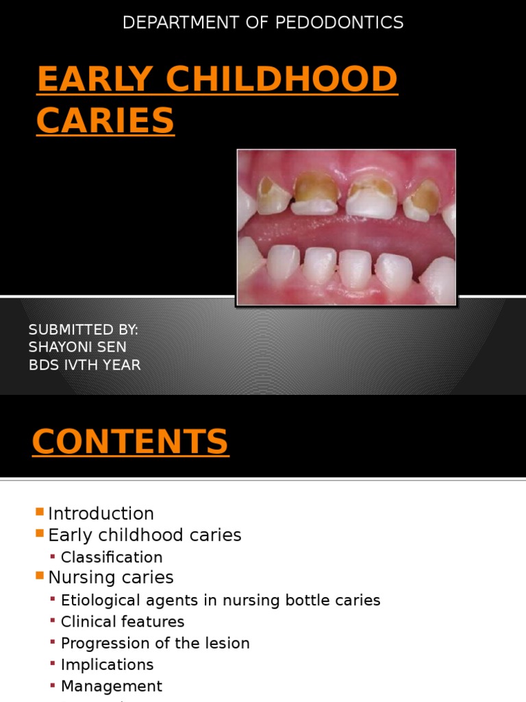 Early Childhood Caries: Department of Pedodontics | PDF | Clinical ...