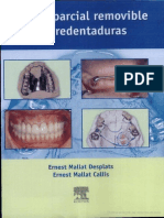 Prótesis Parcial Y Sobredentadura