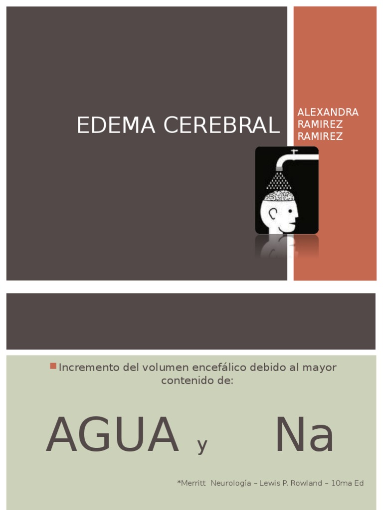 Como Hacer Que Alexa Lea Un Pdf