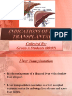 29920335 Liver Transplantation