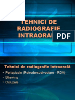 04 Tehnici Radiografie Intraorala (1)