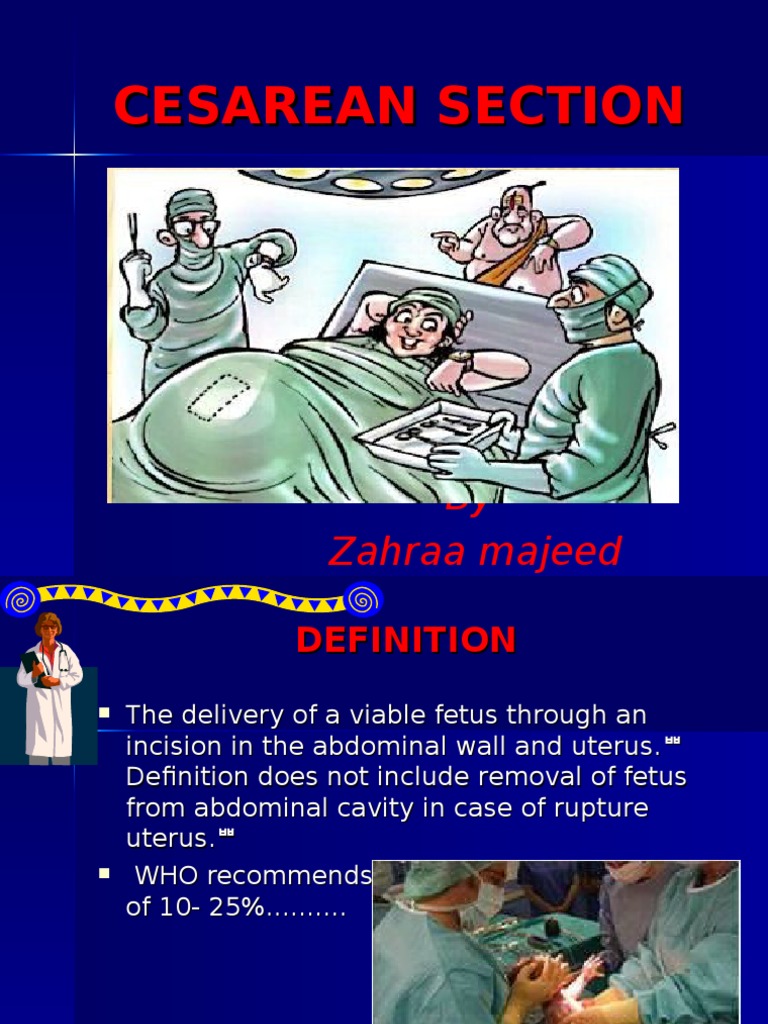 cesarean section powerpoint presentation