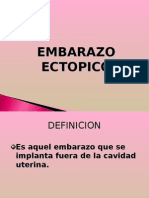 EMBARAZO_ECTOPICO