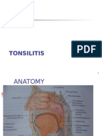 Tonsilitisada