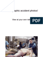Graphic Accident Photos