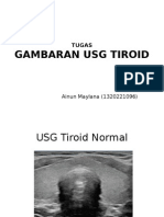 Tugas Usg Tiroid