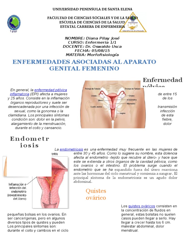 4 Enfermedades Del Aparato Reproductor Femenino Cáncer