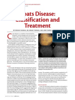 Coats Disease: Classification and Treatment: by Rishav Kansal, Bs Kiran Turaka, MD and Carol L. Shields, MD