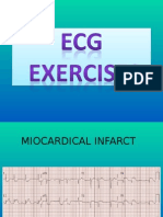 EKG Exercises