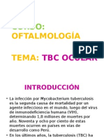 Exposicion TBC Ocular