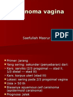 Karsinoma Vagina