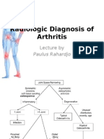 artritis