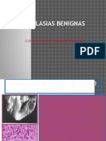 Neoplasias Benignas