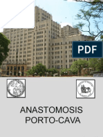 Anastomosis Portocava