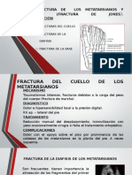 Clase 39 Fractura de Los Metatarsianos y Falanges