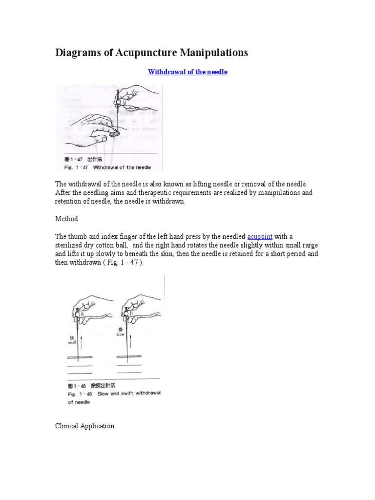 Acupuncture Needle Withdrawal Techniques | PDF | Acupuncture | Clinical ...