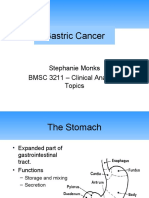 Gastric Cancer: Stephanie Monks BMSC 3211 - Clinical Anatomy Topics