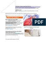 Problem-Mitral-Valve-Stenosis Ucm 450370 Article - Jsp#.Vijwzx4Rliu