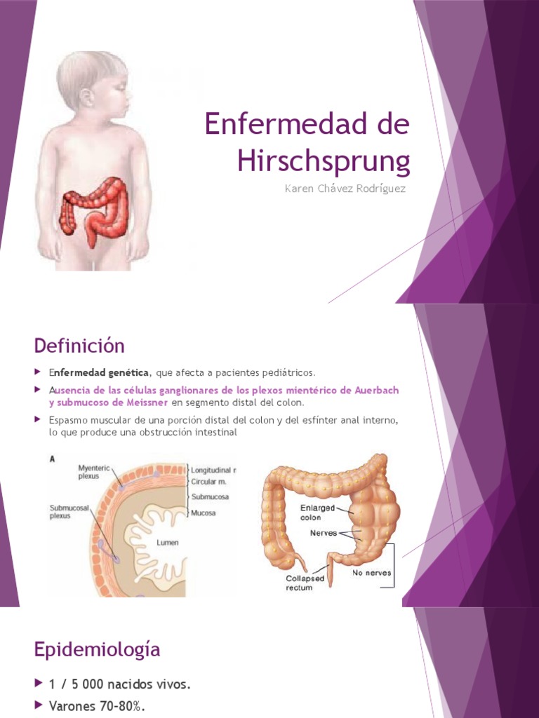 Enfermedad de Hirschsprung Sistema digestivo Gastroenterología