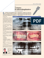 Autoloigados y Micro Parafusos PDF