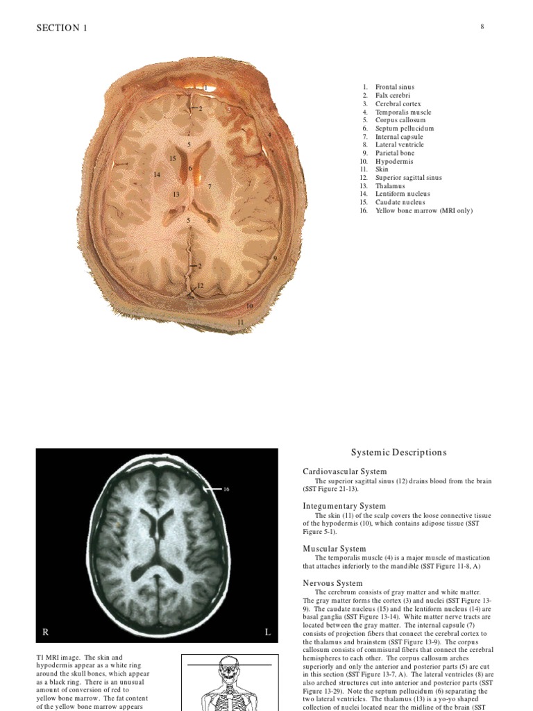 Atlas of Brain | PDF | Abdomen | Lung