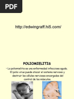 Download Poliomielitis by eDWiNCiTo SN2878620 doc pdf