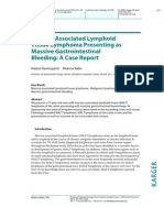 Mucosa-Associated Lymphoid Tissue Lymphoma Presenting As Massive Gastrointestinal Bleeding: A Case Report