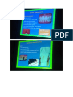 Diagnostico de La Enfermedad Periodontal Parte II