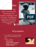 Hypospadias SDC