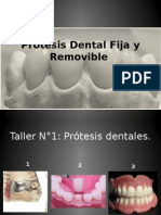 Prótesis Dental Fija y Removible