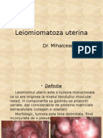 Leiomiomatoza Uterina