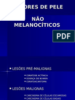 Lesões Não Melanocíticas