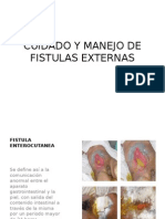 Cuidado y Manejo de Fistulas Externas