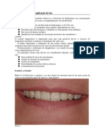 Caso Clínico - Clareamento de Dentes Vitais Com Luz