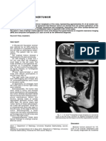 Left Ovarian Brenner Tumor: Key-Word: Ovary, Neoplasms