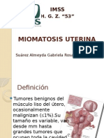 Miomatosis Uterina-Hgz 53